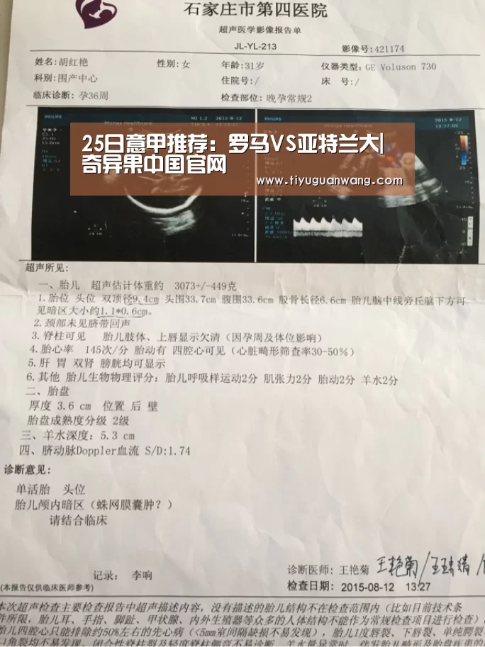 25日意甲推荐:罗马VS亚特兰大|奇异果中国官网(图3) 奇异果官网首页